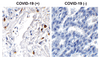 SARS-CoV-2 (COVID-19) ORF7a Antibody |9285