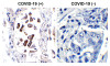 SARS-CoV-2 (COVID-19) ORF8 Antibody | 9287