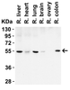 Beclin-1 Antibody