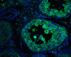 Autophagy Protein Detection Set