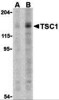 TOR Signaling Pathway Detection Set