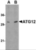 ATG12 Antibody