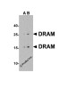 DRAM Antibody