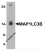 MAP1LC3B Antibody