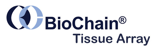 Biochain Tissue Array