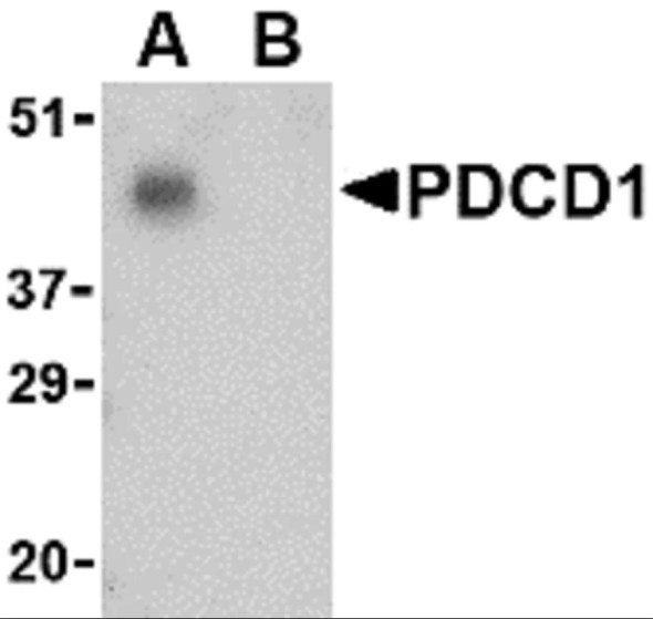 PD-1 Antibody | 4065