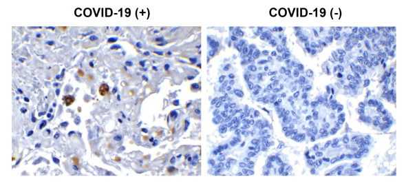 SARS-CoV-2 (COVID-19) NSP13 (Helicase) Antibody | 9183