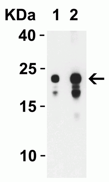 SARS-CoV-2 (COVID-19) ORF3b Antibody | 9277