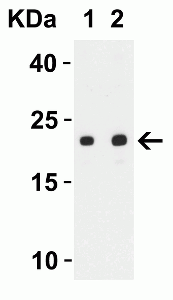 SARS-CoV-2 (COVID-19) ORF3b Antibody | 9279