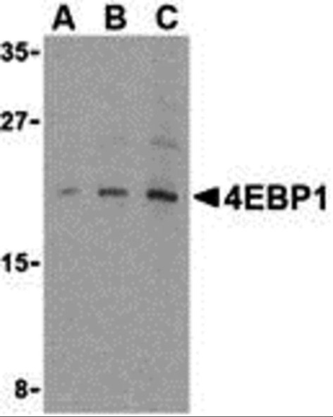 TOR Signaling Pathway Detection Set