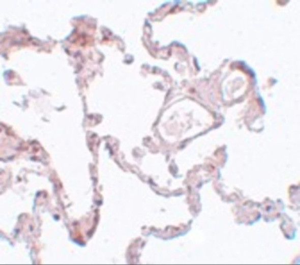 PLEKHM1 Antibody