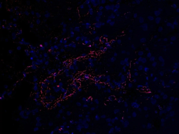 SARS-CoV-2 (COVID-19) Envelope Antibody | 3531