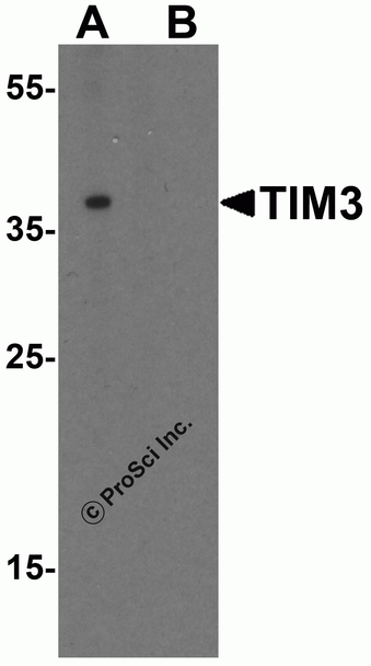 TIM-3 Antibody