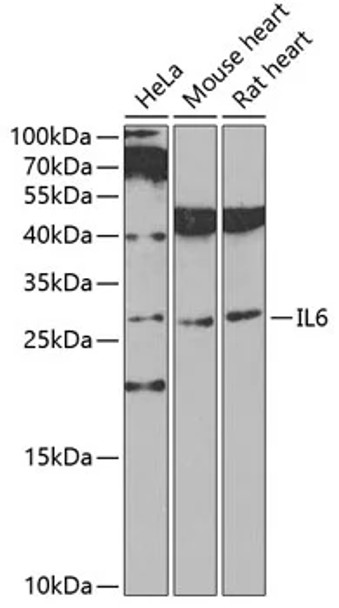 IL6 Antibody | 13-129