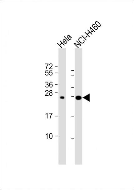 IL6 Antibody | 56-451