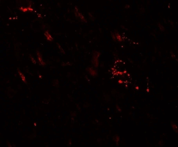 MAP1LC3A Antibody