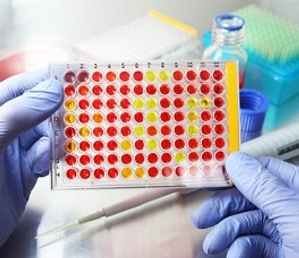 IgE AccuBind ELISA Kit