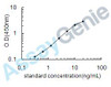 Human Platelet factor 4 (PF4) ELISA Kit (HUEB0454)
