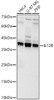 IL12B Polyclonal Antibody (CAB23054)