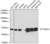 Western blot analysis of various lysates using β-Tubulin Mouse mAb (CABC021) at 1:5000 dilution. Secondary antibody: HRP-conjugated Goat anti-Mouse IgG (H+L) (CABS003) at 1:10000 dilution. Lysates/proteins: 25μg per lane. Blocking buffer: 3% nonfat dry milk in TBST. Detection: ECL Basic Kit (AbGn00020). Exposure time: 10s.