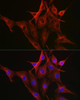 Immunofluorescence analysis of NIH-3T3 cells using β-Tubulin Mouse mAb (CABC021) at dilution of 1:100 (40x lens). Blue: DAPI for nuclear staining.