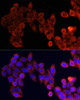 Anti-mTOR Polyclonal Antibody (CAB2445)