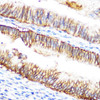 Anti-Raf1 Antibody (CAB0223)