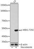 Anti-Phospho-MEK1-T292 [ARC1566] Monoclonal Antibody (CABP1021)