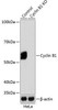 Anti-Cyclin B1 Monoclonal Antibody -Knockout Validated (CAB19037)