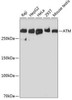 Anti-ATM [ARC0129] Monoclonal Antibody (CAB19650)