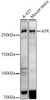 Anti-ATR [ARC51749] Monoclonal Antibody (CAB21253)