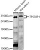 Anti-TP53BP1 Polyclonal Antibody (CAB21632)