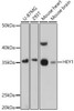 Anti-HEY1 Antibody (CAB16110)