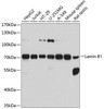 Anti-Lamin B1 Antibody -Knockout Validated (CAB1910)