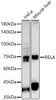 Anti-RELA Polyclonal Antibody (CAB22676)