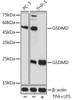 Anti-GSDMD (Full Length+C terminal) Antibody (CAB17308)