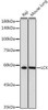 Anti-LCK Antibody (CAB2177)