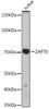 Anti-ZAP70 [ARC51229] Monoclonal Antibody (CAB9536)