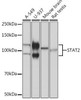 Anti-STAT2 [ARC51796] Monoclonal Antibody (CAB3588)