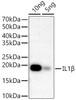 Anti-IL1beta [ARC56180] Monoclonal Antibody (CAB22257)