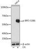 Anti-Phospho-IRF3-S386 [ARC1539] Monoclonal Antibody (CABP0995)