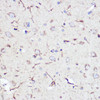 Anti-GFAP Antibody (CAB0237)