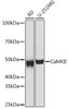 Anti-CaMKII [ARC53334] Monoclonal Antibody (CAB0186)