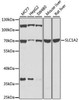Anti-EAAT2/SLC1A2 Antibody (CAB0910)