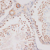 Anti-DDIT3/CHOP Antibody (CAB0221)