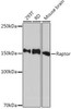 Anti-Raptor [ARC1375] Monoclonal Antibody (CAB8992)
