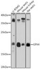 Anti-GPX4 Antibody (CAB1933)