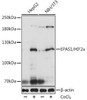 Anti-EPAS1/HIF2alpha Antibody (CAB7553)