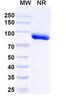 Anti-Trastuzumab Idiotypic Antibody [1HE]