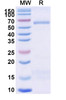 Anti-Trastuzumab Idiotypic Antibody [1HE]